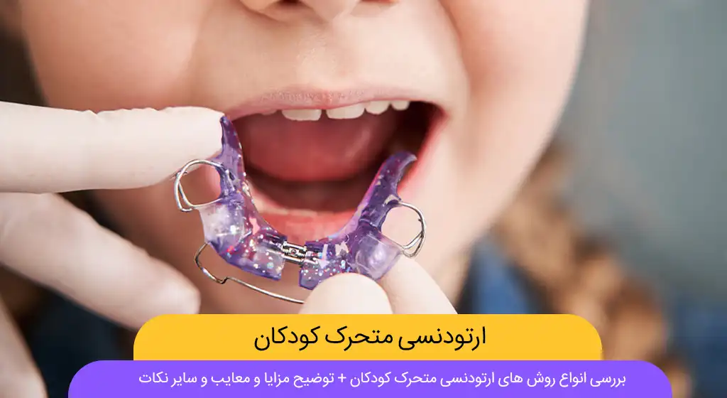 ارتودنسی متحرک کودکان شاخص
