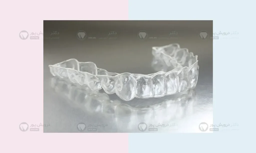 ارتودنسی نامریی دندان خرگوشی