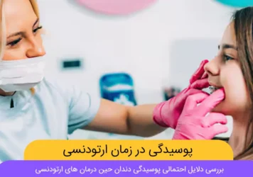 پوسیدگی دندان حین درمان ارتودنسی شاخص