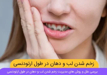 زخم شدن لب و دهان در طول ارتودنسی شاخص