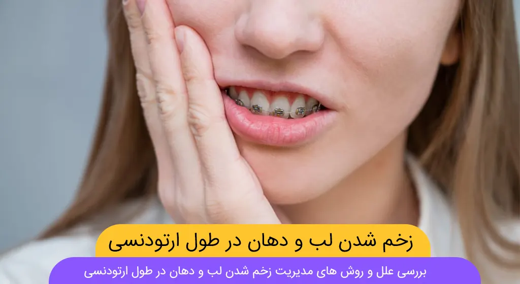 زخم شدن لب و دهان در طول ارتودنسی شاخص