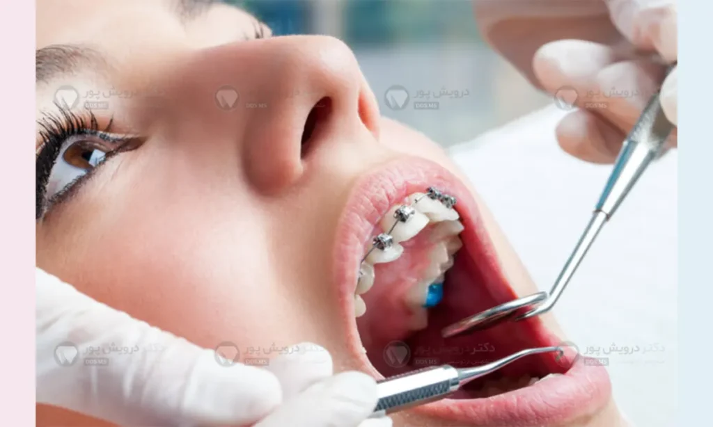 معاینه دندانپزشکی