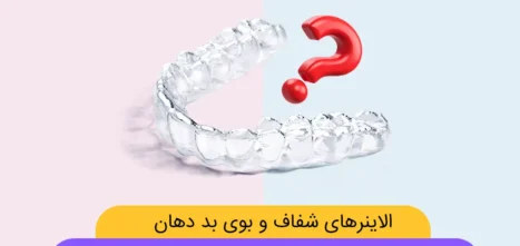 آیا الاینرهای شفاف باعث بوی بد دهان می شوند؟ شاخص