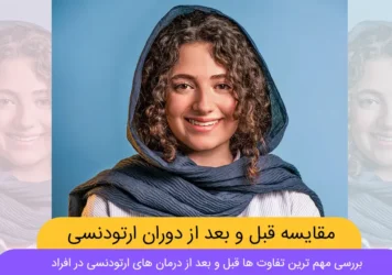 قبل و بعد از ارتودنسی شاخص