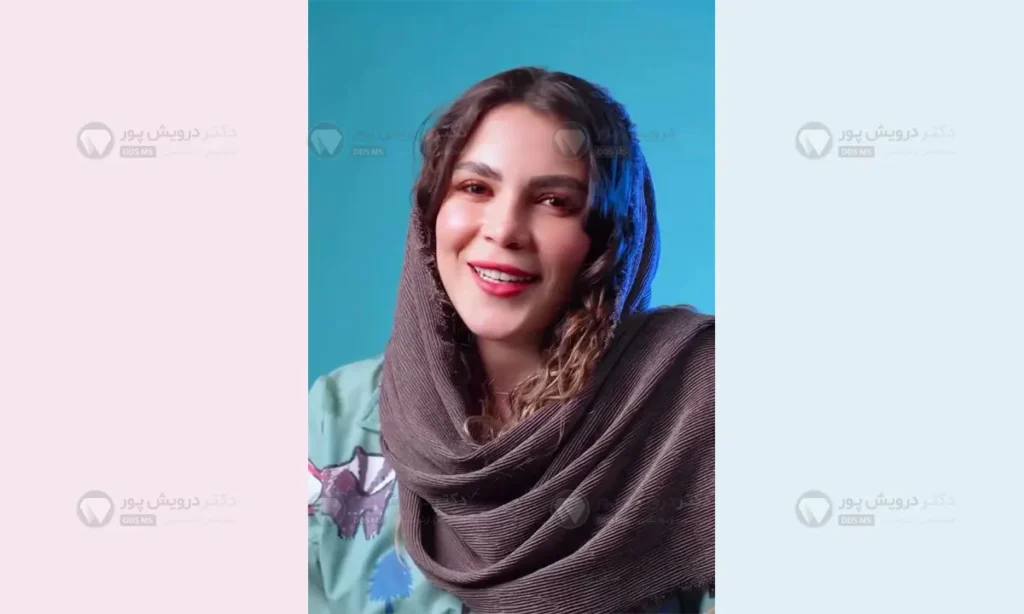 لبخند زدن بعد از ارتودنسی