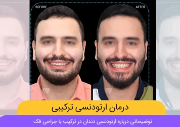ارتودنسی ترکیبی شاخص