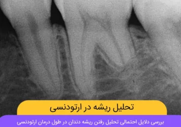 تحلیل ریشه در ارتودنسی