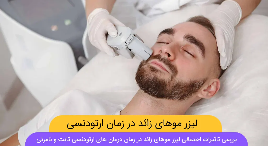 لیزر موهای زائد در زمان ارتودنسی شاخص