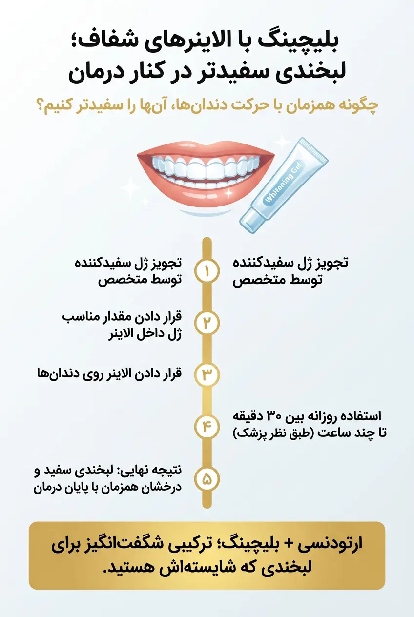 مراحل بلیچینگ با ارتودنسی نامرئی