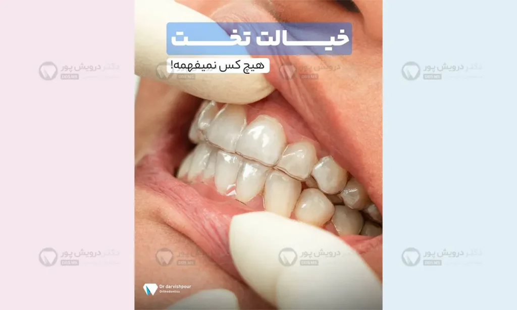 الاینرهای شفاف کاملا نامرئی هستند