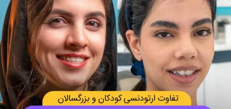 تفاوت ارتودنسی کودکان و بزرگسالان شاخص