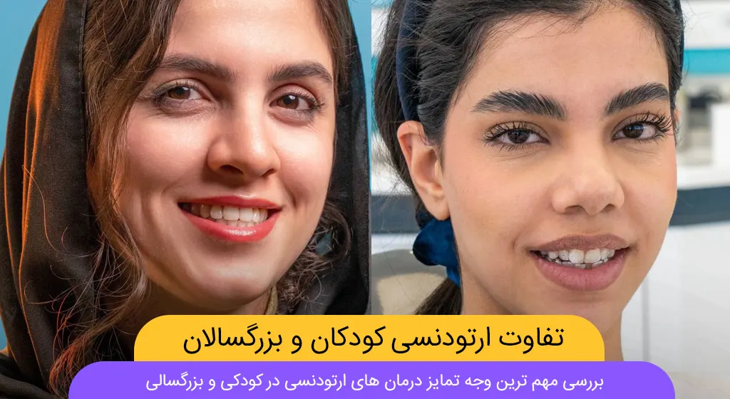 تفاوت ارتودنسی کودکان و بزرگسالان شاخص