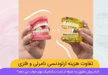 تفاوت هزینه ارتودنسی نامرئی و فلزی شاخص