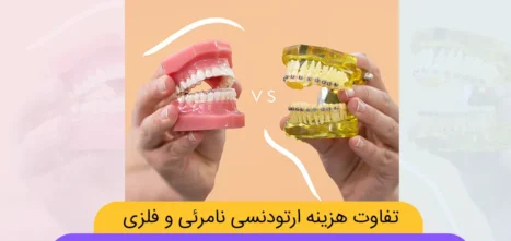 تفاوت هزینه ارتودنسی نامرئی و فلزی شاخص