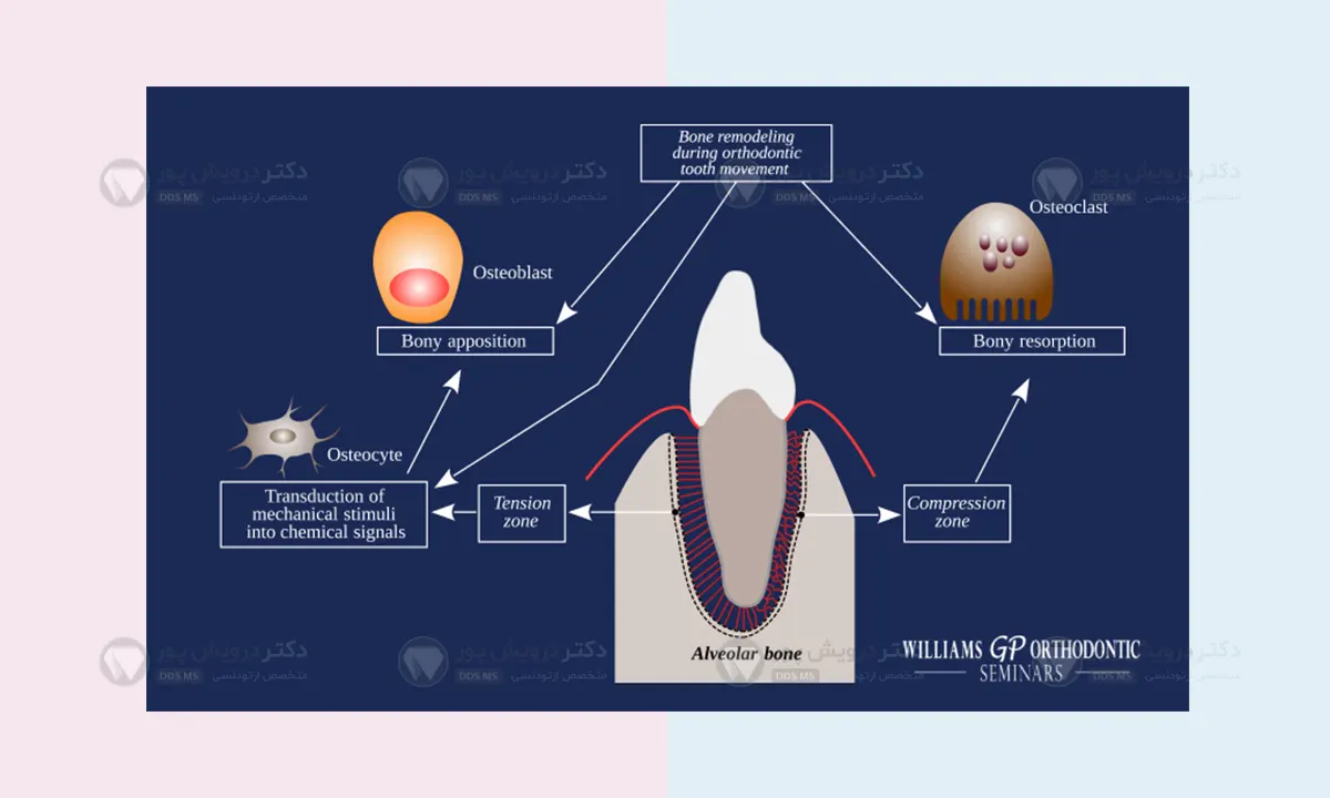حرکت دندان ها در ارتودنسی