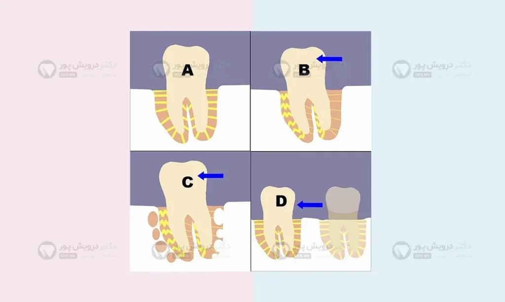 حرکت دندان ها