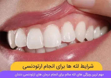 ویژگی های لثه سالم برای ارتودنسی