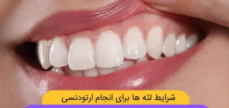 ویژگی های لثه سالم برای ارتودنسی