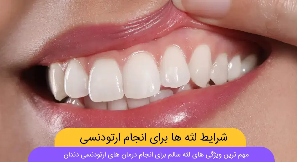 ویژگی های لثه سالم برای ارتودنسی