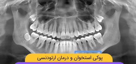 ارتودنسی و پوکی استخوان