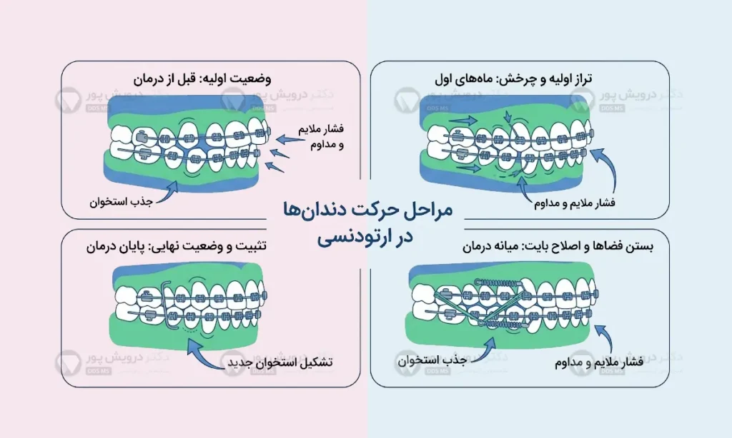 حرکات ارتودنسی در زمان درمان