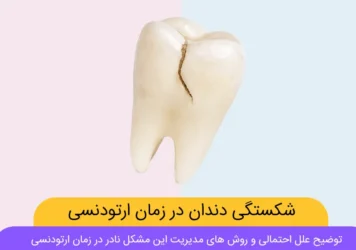 شکستگی دندان در طول ارتودنسی شاخص