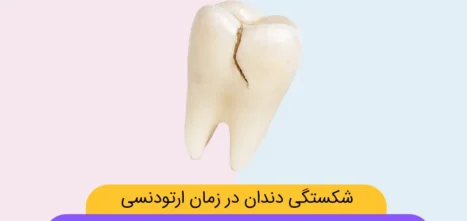 شکستگی دندان در طول ارتودنسی شاخص
