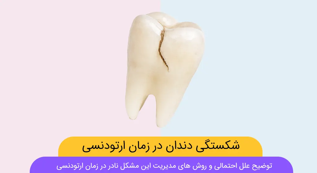 شکستگی دندان در طول ارتودنسی شاخص