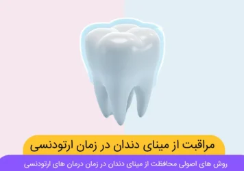 مراقبت از مینای دندان در طول ارتودنسی شاخص