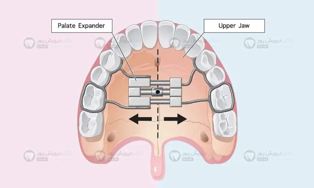 شماتیک هایرکس