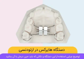 دستگاه هایرکس