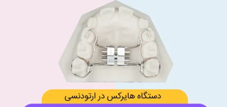 دستگاه هایرکس
