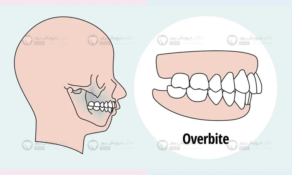 شماتیک اوربایت