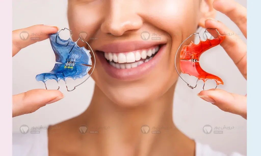 نگهدارنده ارتودنسی