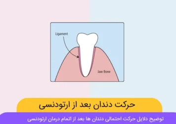 حرکت دندان ها در ارتودنسی