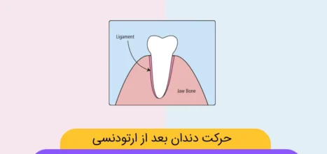 حرکت دندان ها در ارتودنسی