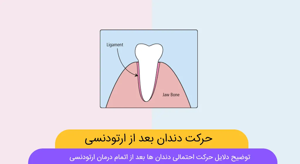 حرکت دندان ها در ارتودنسی