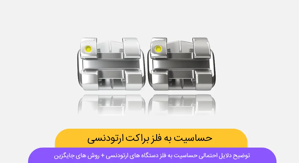 حساسیت به فلز براکت های ارتودنسی شاخص