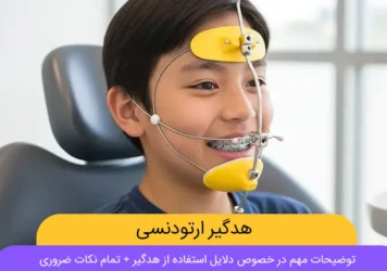 هدگیر ارتودنسی شاخص