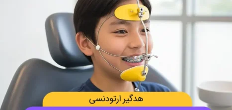 هدگیر ارتودنسی شاخص