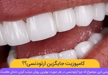 کامپوزیت به جای ارتودنسی شاخص