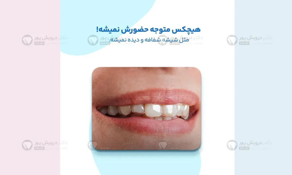 عکس الاینر شفاف ارتودنسی