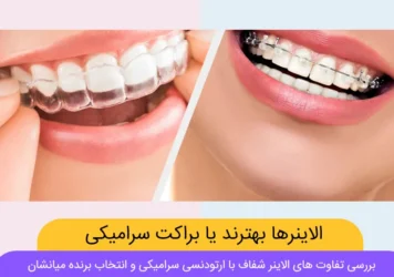 الاینرهای شفاف بهترند یا ارتودنسی سرامیکی شاخص