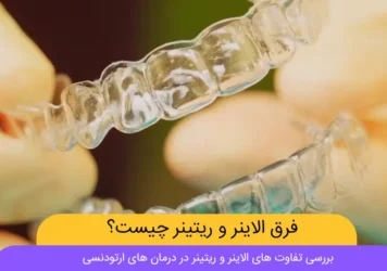فرق الاینر و ریتینر شاخص