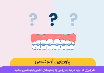 پاورچین ارتودنسی شاخص
