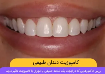 کامپوزیت دندان طبیعی شاخص