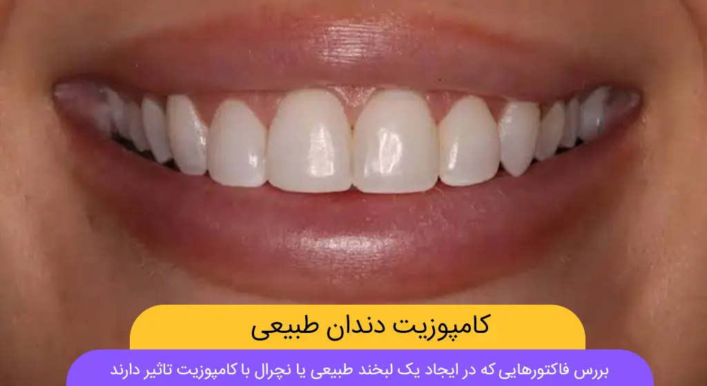 کامپوزیت دندان طبیعی شاخص