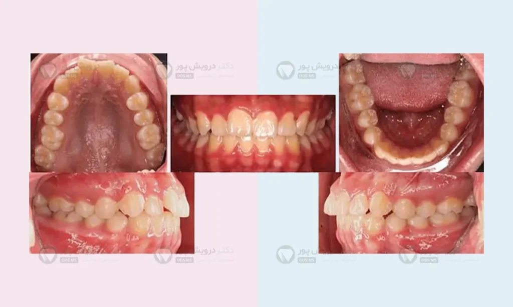 فتوگرافی در ارتودنسی (از تمام زوایا)