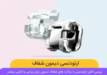 ارتودنسی دیمون شفاف شاخص