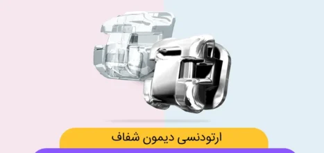 ارتودنسی دیمون شفاف شاخص
